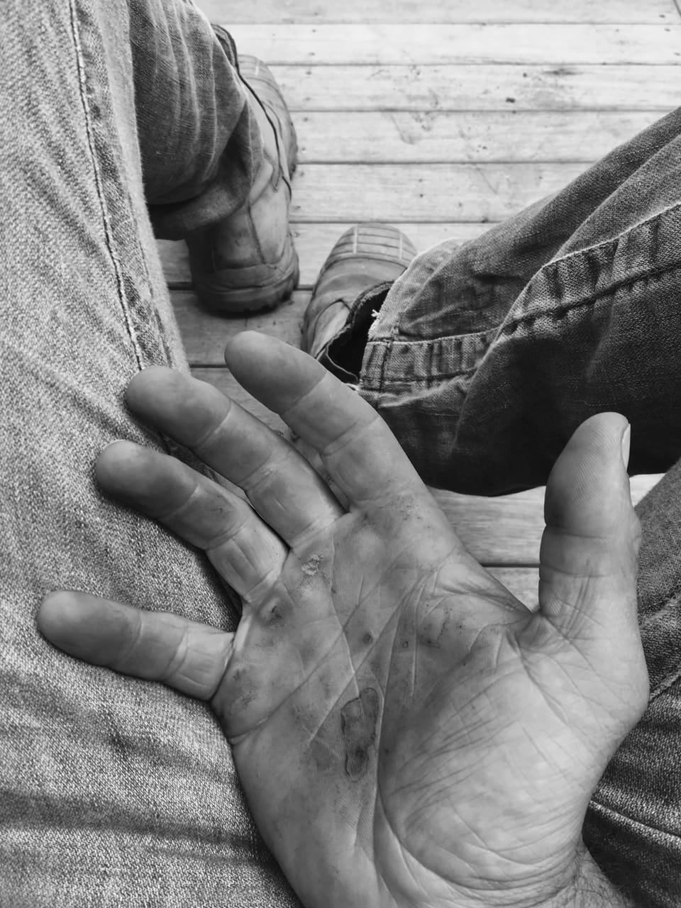 Those Days in the Dirt